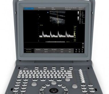 CHISON  ECO 2